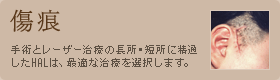 傷痕