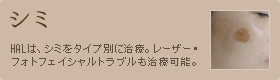 シミ