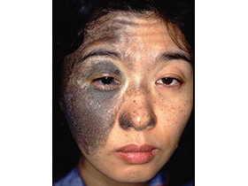 40歳:治療前 (写真はご本人の承諾を得て使用しています。)