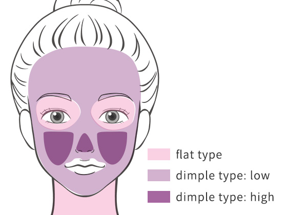 目立つ毛穴(dimple type)は、鼻の中下2/3の部分と鼻に接している両側頬部の皮膚に存在